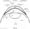 Fig. 03 - Electronics assembly for use in electronic contact lens