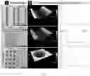 Fig. 08 - Electrochemical imprinting of micro- and nano-structures in porous silicon, silicon, and other semiconductors