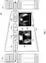 Fig. 04 - Data anonymization for data labeling and development purposes