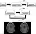 Fig. 01 - Systems and methods for improving magnetic resonance imaging using deep learning