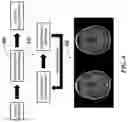 Fig. 05 - Systems and methods for improving magnetic resonance imaging using deep learning