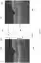 Fig. 06 - IMAGE QUALITY IMPROVEMENT METHODS FOR OPTICAL COHERENCE TOMOGRAPHY