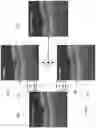 Fig. 07 - IMAGE QUALITY IMPROVEMENT METHODS FOR OPTICAL COHERENCE TOMOGRAPHY