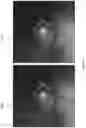 Fig. 09 - IMAGE QUALITY IMPROVEMENT METHODS FOR OPTICAL COHERENCE TOMOGRAPHY