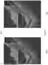 Fig. 10 - IMAGE QUALITY IMPROVEMENT METHODS FOR OPTICAL COHERENCE TOMOGRAPHY