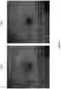 Fig. 16 - IMAGE QUALITY IMPROVEMENT METHODS FOR OPTICAL COHERENCE TOMOGRAPHY
