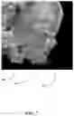 Fig. 08 - SYSTEM AND METHOD FOR TUMOR TRACKING