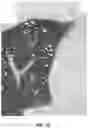 Fig. 04 - Pulmonary analysis using transpulmonary pressure