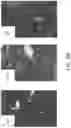 Fig. 06 - Pulmonary analysis using transpulmonary pressure