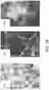 Fig. 07 - Pulmonary analysis using transpulmonary pressure