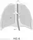 Fig. 11 - Pulmonary analysis using transpulmonary pressure