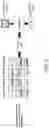 Fig. 14 - Pulmonary analysis using transpulmonary pressure