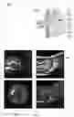 Fig. 06 - Determination and visualization of damage to an anatomical joint
