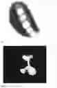 Fig. 03 - Determining rotation axis from x-ray radiographs