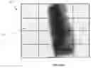 Fig. 06 - Determining rotation axis from x-ray radiographs
