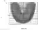 Fig. 07 - Determining rotation axis from x-ray radiographs