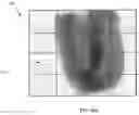 Fig. 08 - Determining rotation axis from x-ray radiographs