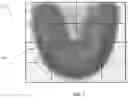 Fig. 09 - Determining rotation axis from x-ray radiographs