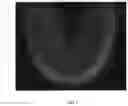 Fig. 12 - Determining rotation axis from x-ray radiographs