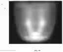 Fig. 13 - Determining rotation axis from x-ray radiographs