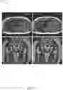Fig. 10 - SYSTEMS AND METHODS FOR MEDICAL IMAGE PROCESSING USING DEEP NEURAL NETWORK