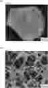Fig. 01 - BRAIN BLOOD VESSEL MODEL AND DEVICE