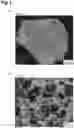 Fig. 02 - BRAIN BLOOD VESSEL MODEL AND DEVICE