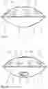 Fig. 03 - Handpan