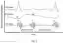 Fig. 05 - Noise cancellation