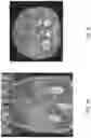 Fig. 12 - System and methods for radiographic image quality assessment and protocol optimization