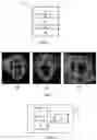 Fig. 02 - IMAGE ANALYSIS METHOD AND DEVICE
