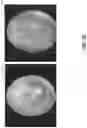 Fig. 04 - MACHINE LEARNING TECHNIQUES TO ASSIST DIAGNOSIS OF EAR DISEASES