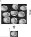 Fig. 05 - MACHINE LEARNING TECHNIQUES TO ASSIST DIAGNOSIS OF EAR DISEASES