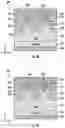 Fig. 12 - Gate trench power semiconductor devices having improved deep shield connection patterns