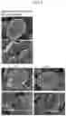 Fig. 04 - ELECTROLYTE SOLUTION FOR LITHIUM SECONDARY BATTERY AND LITHIUM SECONDARY BATTERY INCLUDING THE SAME