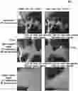 Fig. 01 - Generation of three-dimensional images with digital magnification