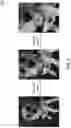 Fig. 05 - Generation of three-dimensional images with digital magnification