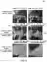 Fig. 08 - Generation of three-dimensional images with digital magnification