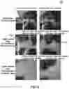 Fig. 09 - Generation of three-dimensional images with digital magnification