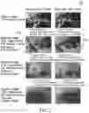 Fig. 10 - Generation of three-dimensional images with digital magnification
