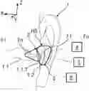 Fig. 01 - Hearing aid system and a method for operating a hearing aid system