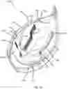 Fig. 27 - Animal restraint