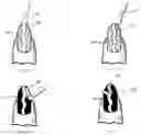 Fig. 03 - Method for Nail Manicuring