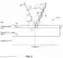 Fig. 06 - Ocular surface interferometry (OSI) for imaging, processing, and/or displaying an ocular tear film