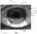 Fig. 08 - Ocular surface interferometry (OSI) for imaging, processing, and/or displaying an ocular tear film