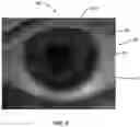 Fig. 09 - Ocular surface interferometry (OSI) for imaging, processing, and/or displaying an ocular tear film