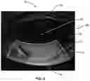 Fig. 10 - Ocular surface interferometry (OSI) for imaging, processing, and/or displaying an ocular tear film
