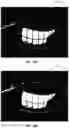 Fig. 28 - Ocular surface interferometry (OSI) for imaging, processing, and/or displaying an ocular tear film