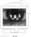 Fig. 35 - Ocular surface interferometry (OSI) for imaging, processing, and/or displaying an ocular tear film