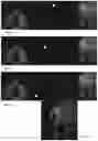 Fig. 05 - MAGNETIC RESONANCE IMAGING METHOD AND DEVICE